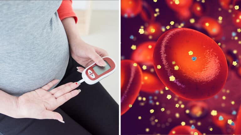 gestational diabetes