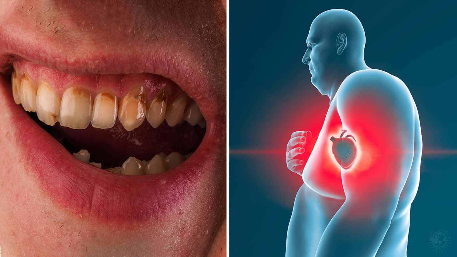 Tokyo Researchers Connect Poor Oral Hygiene to Metabolic Diseases 