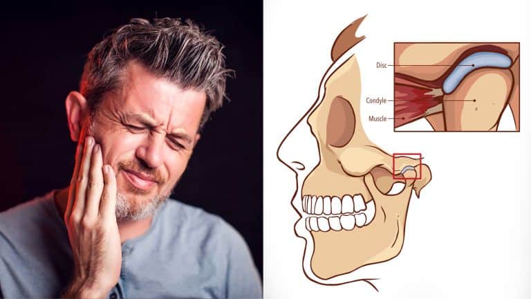 jaw pain