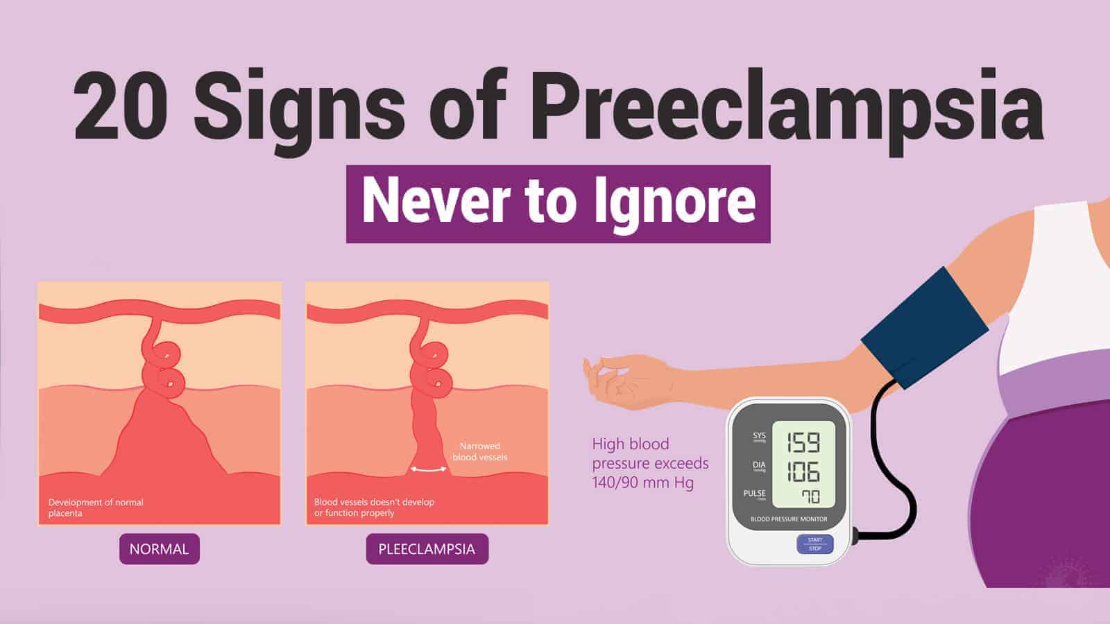 20 Signs of Preeclampsia Never to Ignore