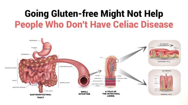 going gluten-free