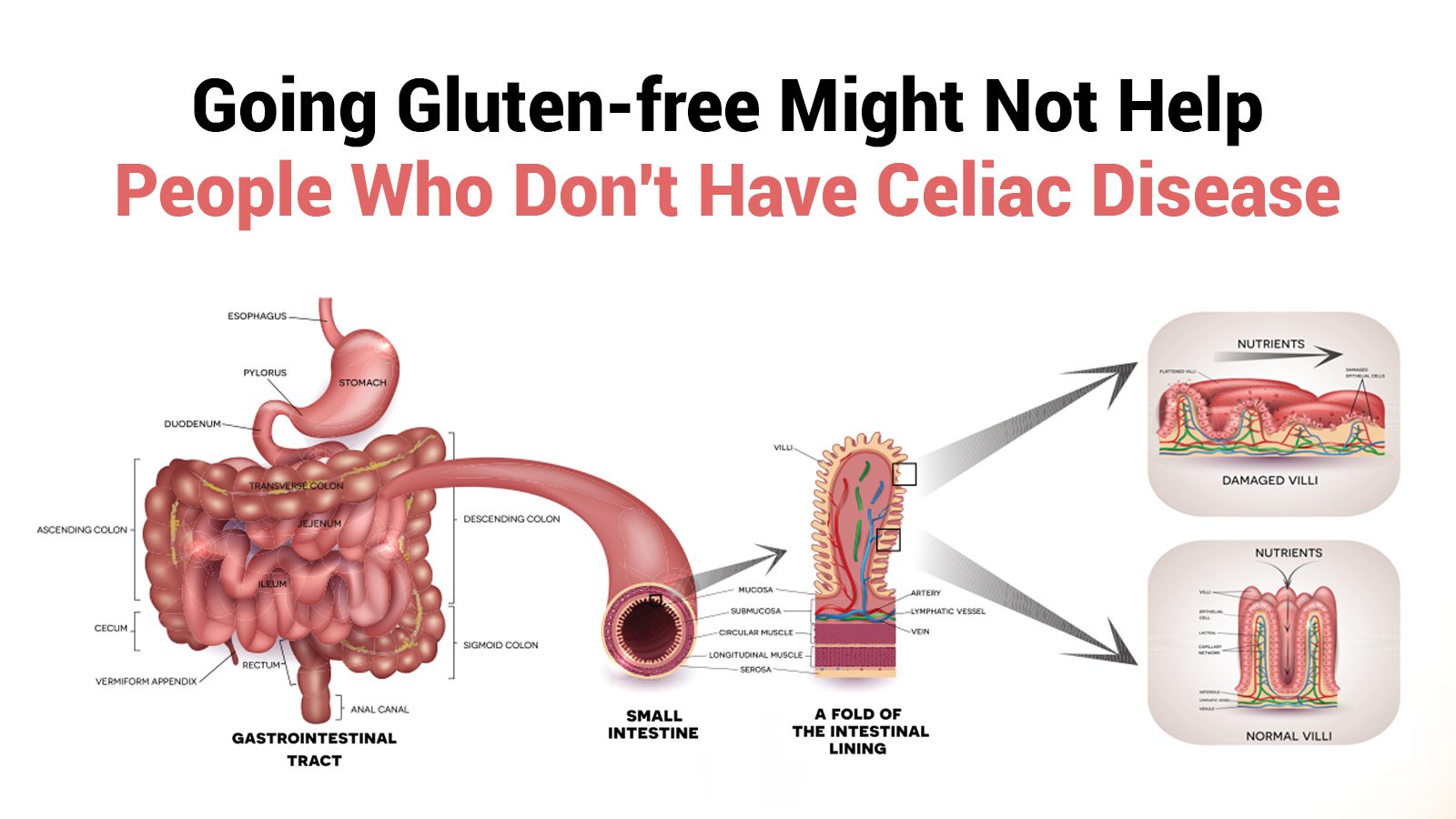 Going Gluten-free Might Not Help People Who Don’t Have Celiac Disease, Study Says