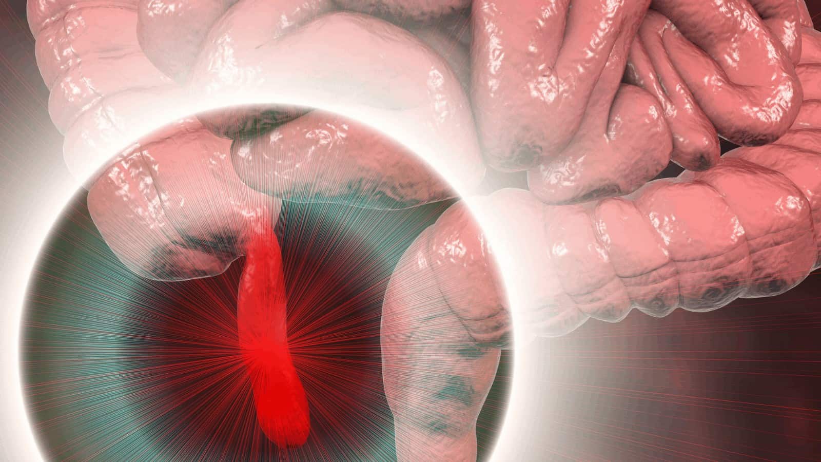 10 Red Flags Reveal Someone’s Appendix Might Rupture