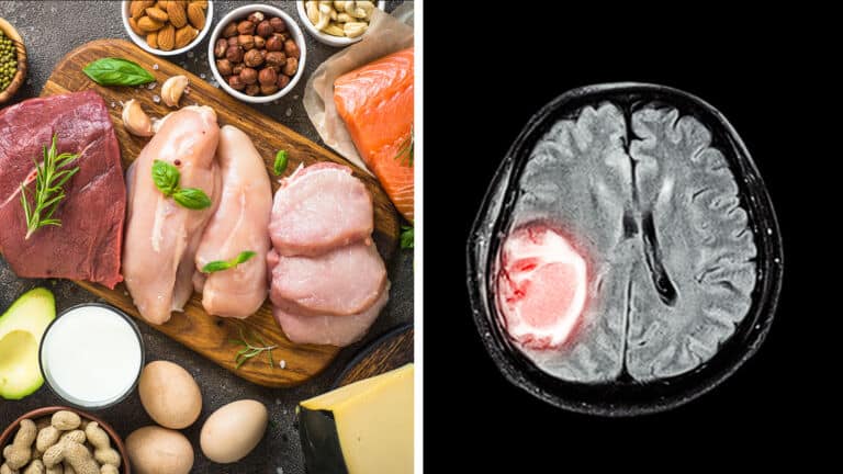 brain tumor growth keto