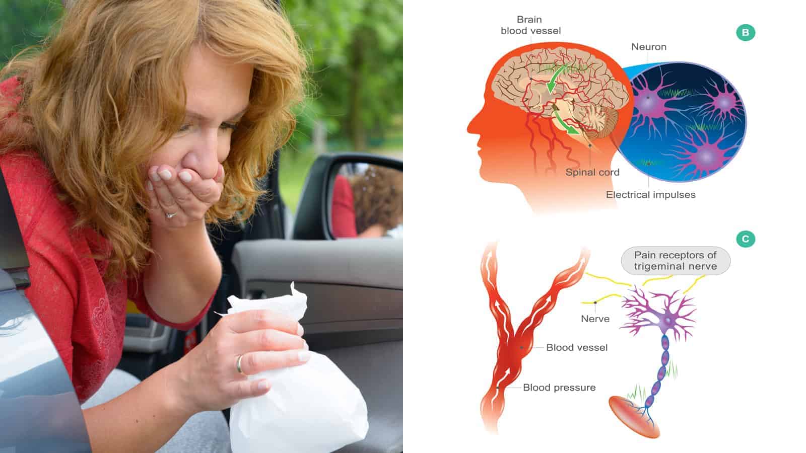 Neurologists Link Motion Sickness to an Increased Risk for Migraines
