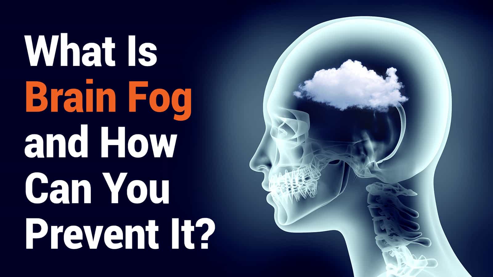 What Is Brain Fog and How Can You Prevent It?
