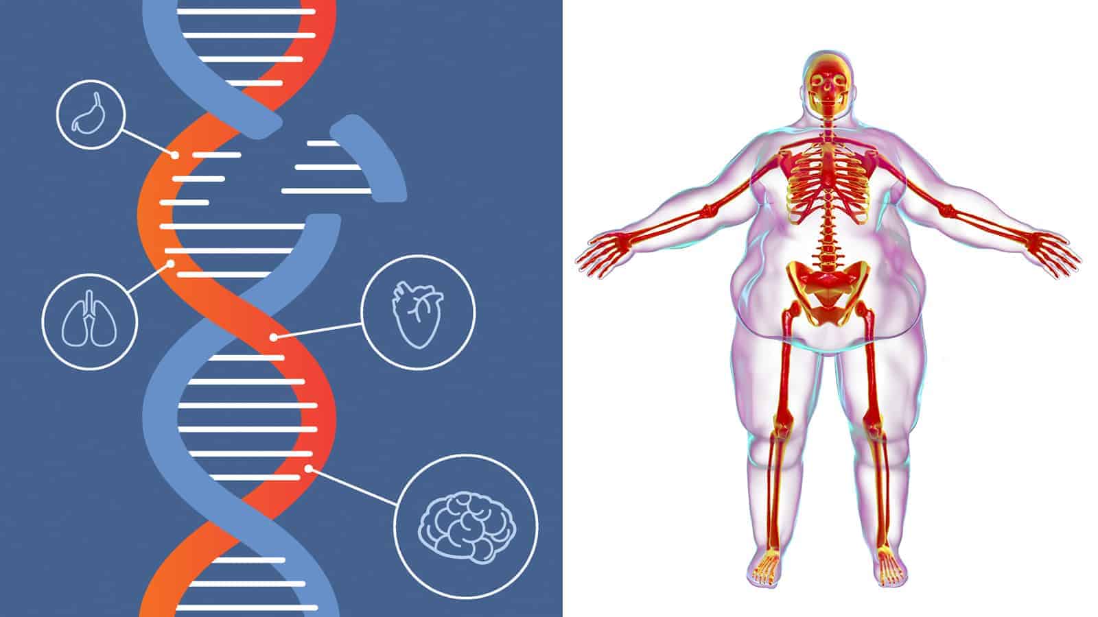 UVA Researchers Explain The 14 Genes That Cause Obesity