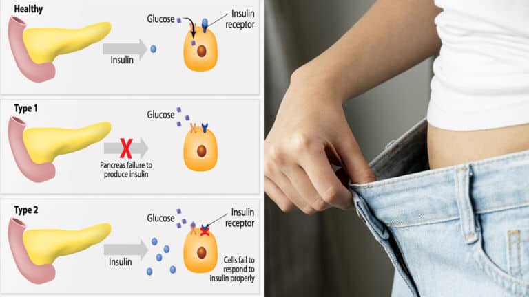 diabetes mellitus