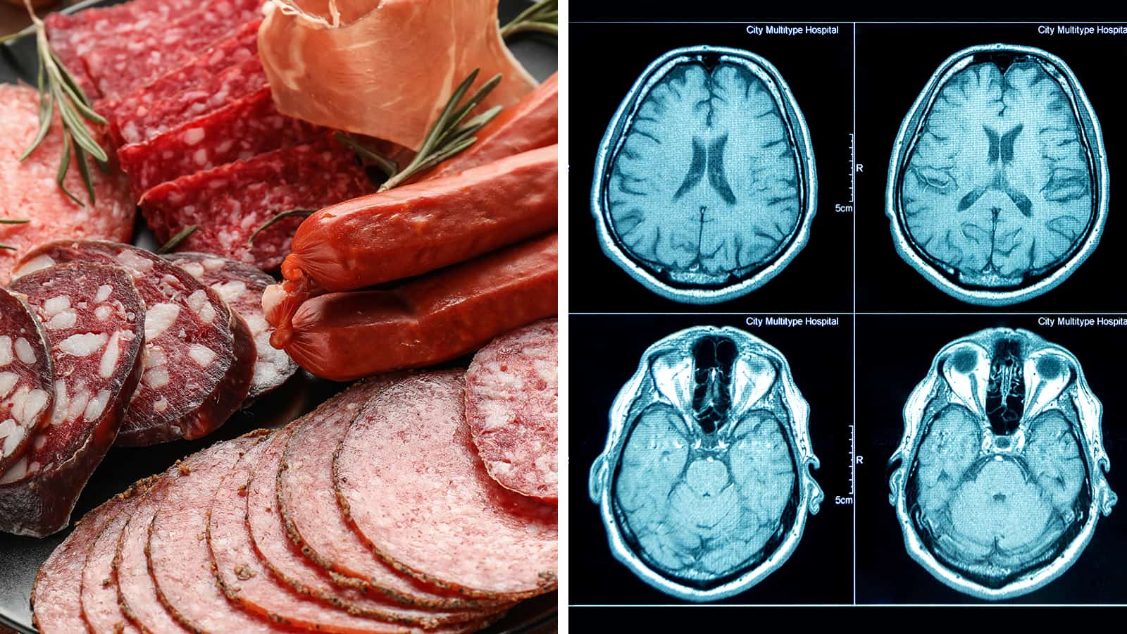 OSU Researchers Explain How Highly Processed Foods Harm the Brain