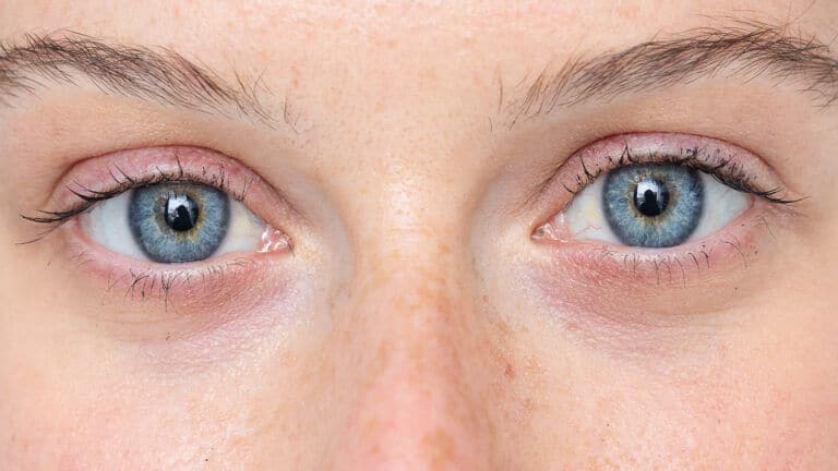 blue eyes