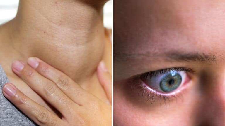 thyroid disease