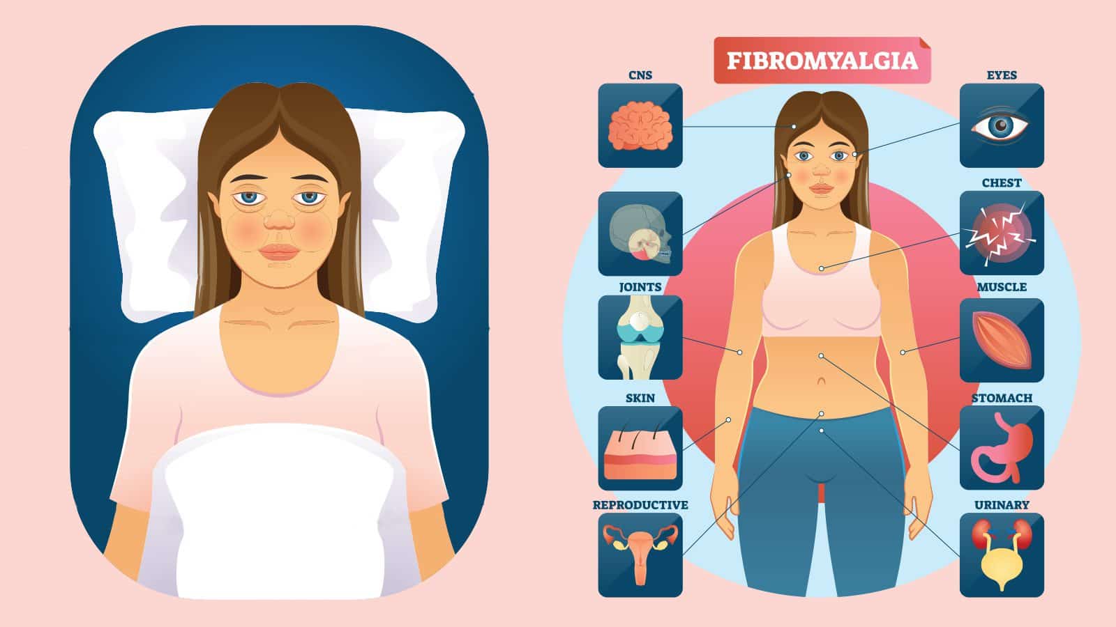 10 Signs of Fibromyalgia to Never Ignore