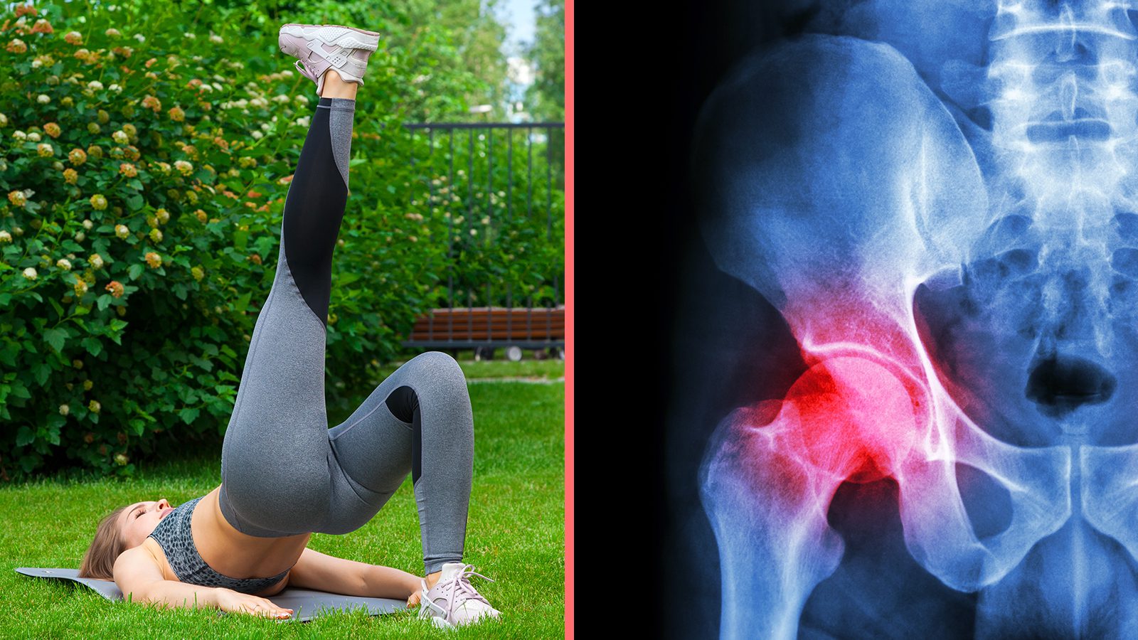 10 Exercises for Hip Pain Never to Ignore