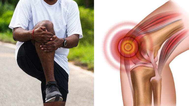 knee pain