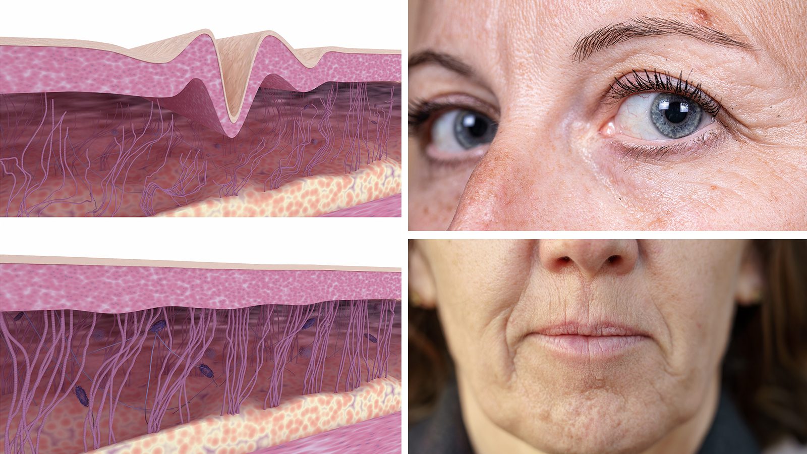 15 Ways to Slow Down Wrinkles And Look Younger