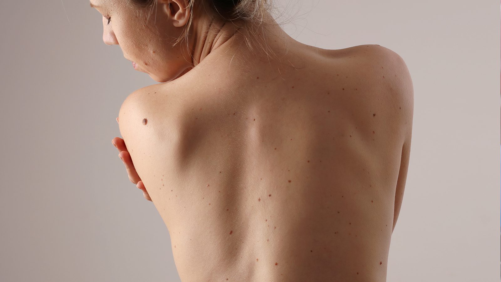 Do a Skin Cancer Self-Exam in 7 Steps 