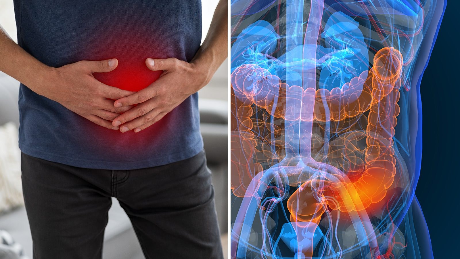9 Hidden Signs of Colon Cancer Most People Ignore