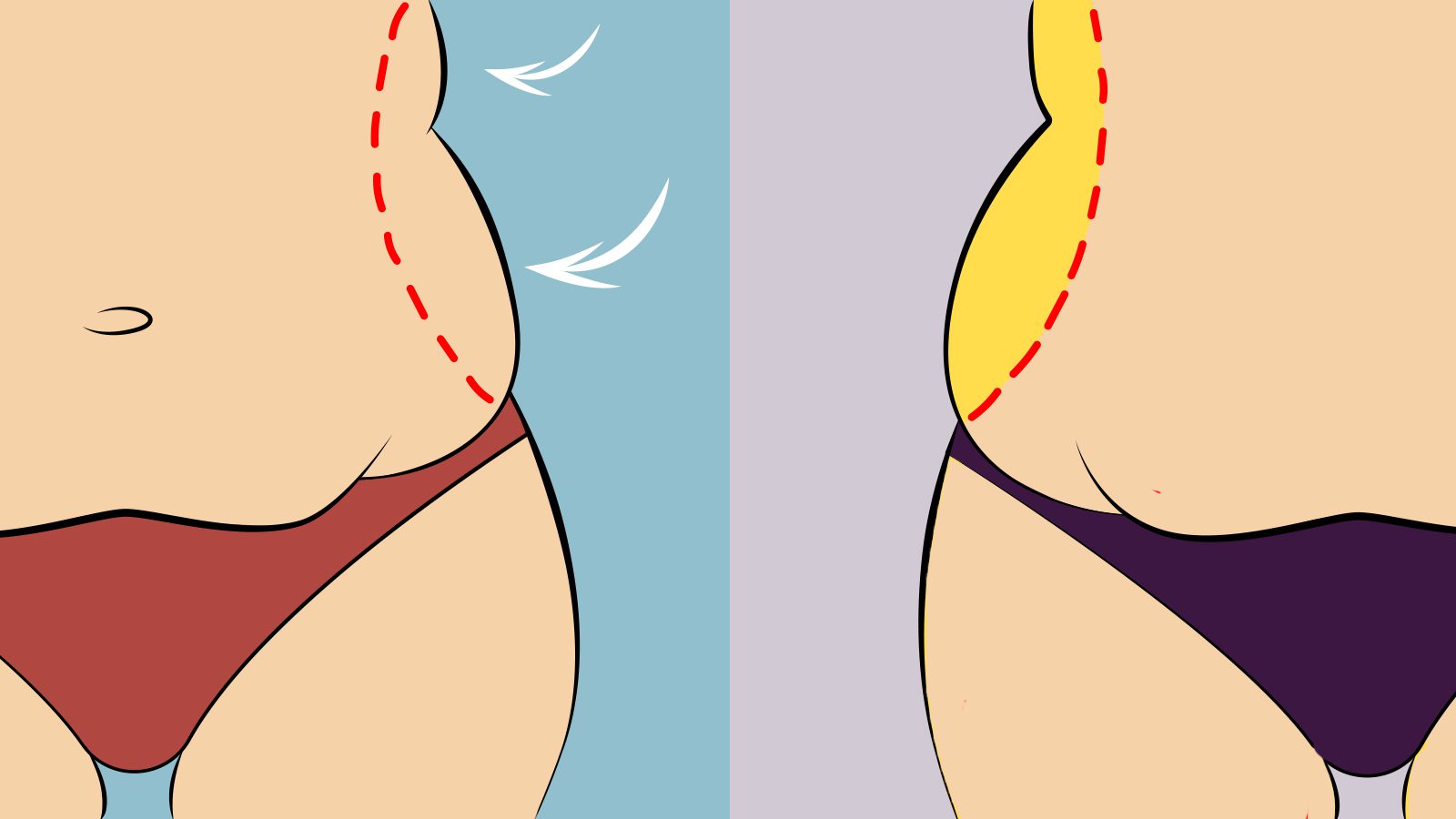 6 Causes of Love Handles (and How to Fix Them)