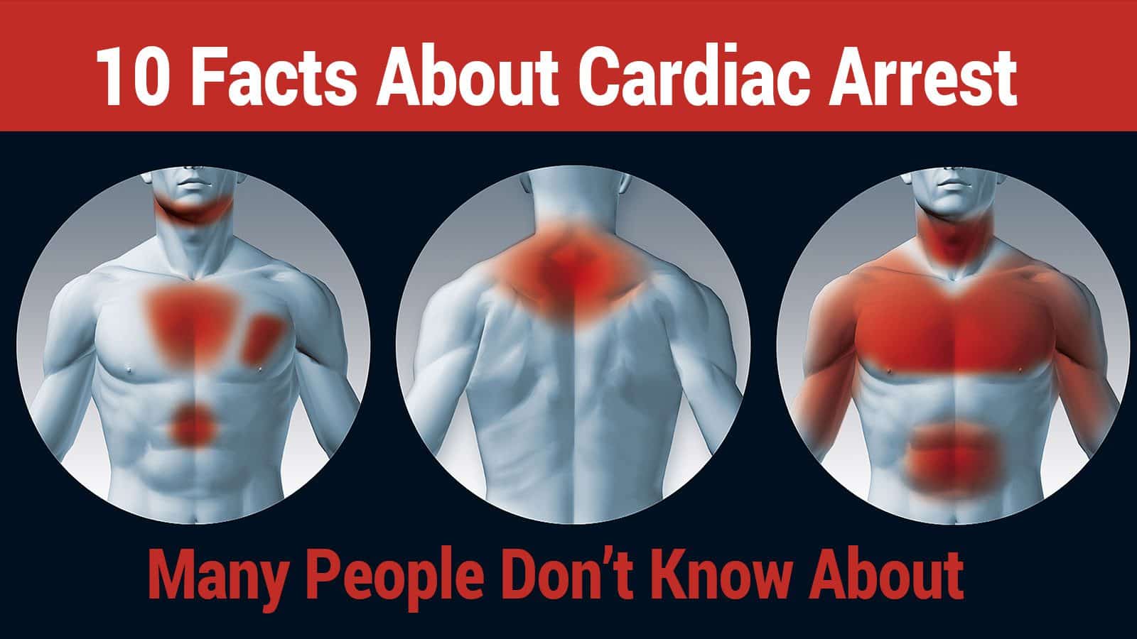 10 Facts About Cardiac Arrest Many People Don’t Know About