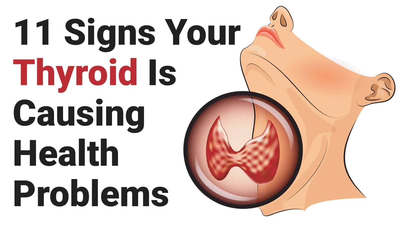 11 Signs Your Thyroid Is Causing Health Problems