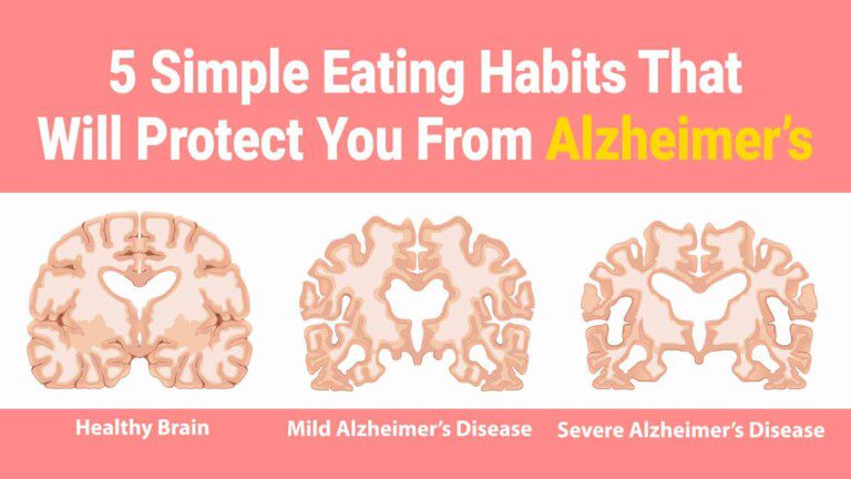 alzheimer's
