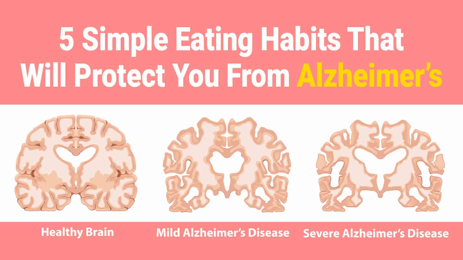5 Simple Eating Habits That Can Protect You From Alzheimer’s