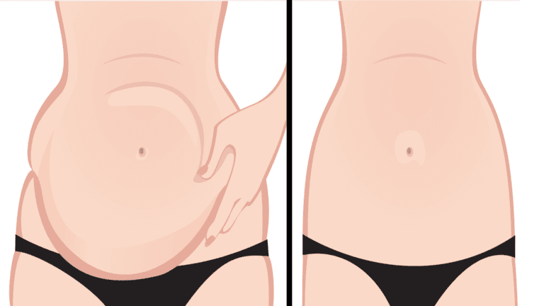 belly fat