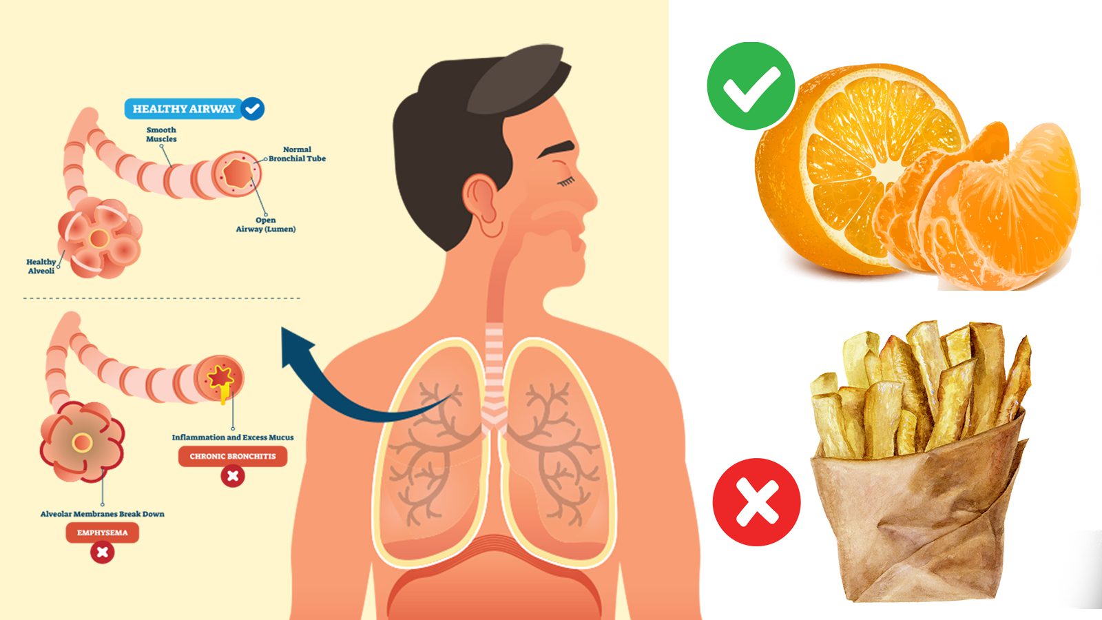 8 Foods to Heal COPD (and 4 Things to Avoid)