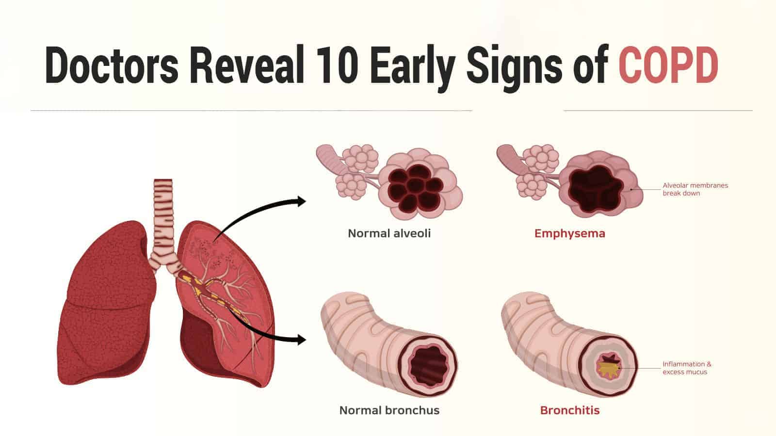 Doctors Reveal 10 Early Signs of COPD