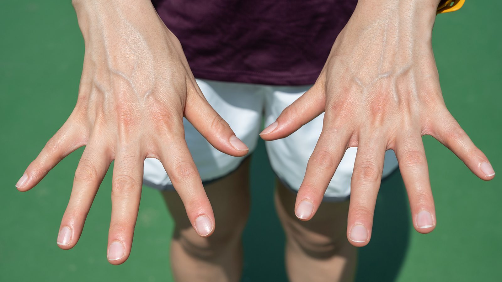 Doctors Explain What Veiny Hands Reveal About Your Health