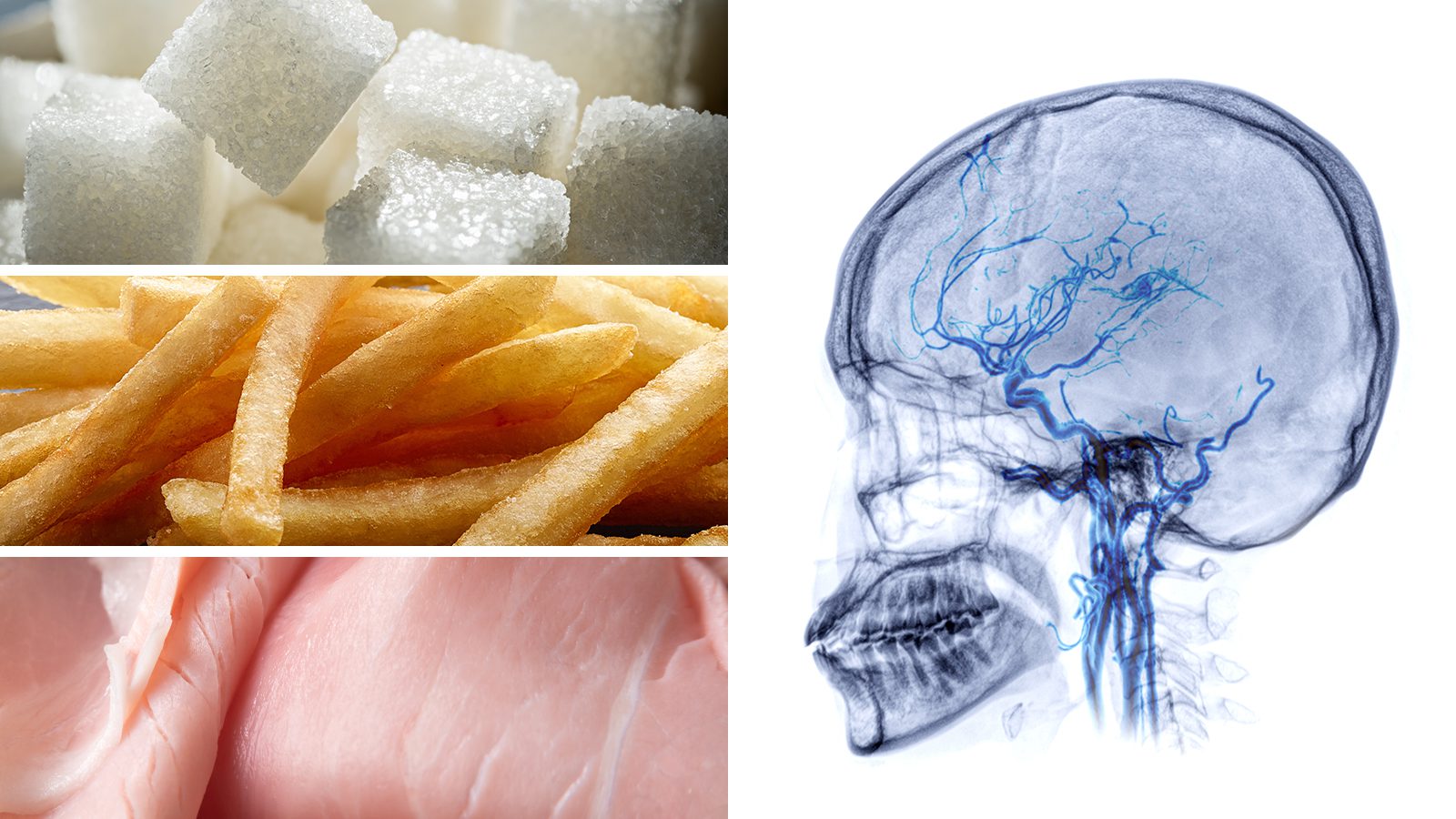 Neurologists Explain 10 Foods That Are Bad for Brain Health
