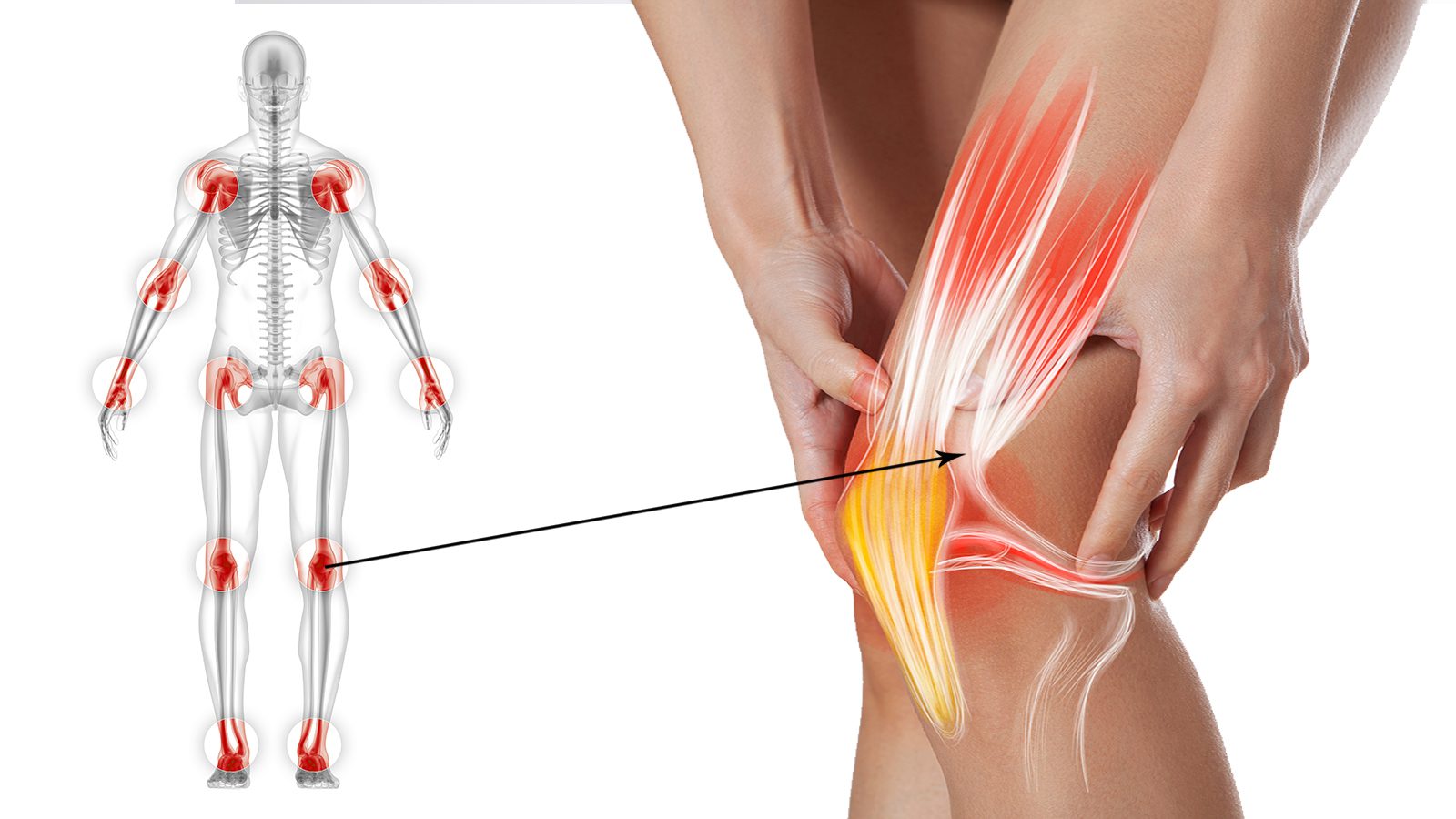 How to Get Joint Pain Relief Without Medicine