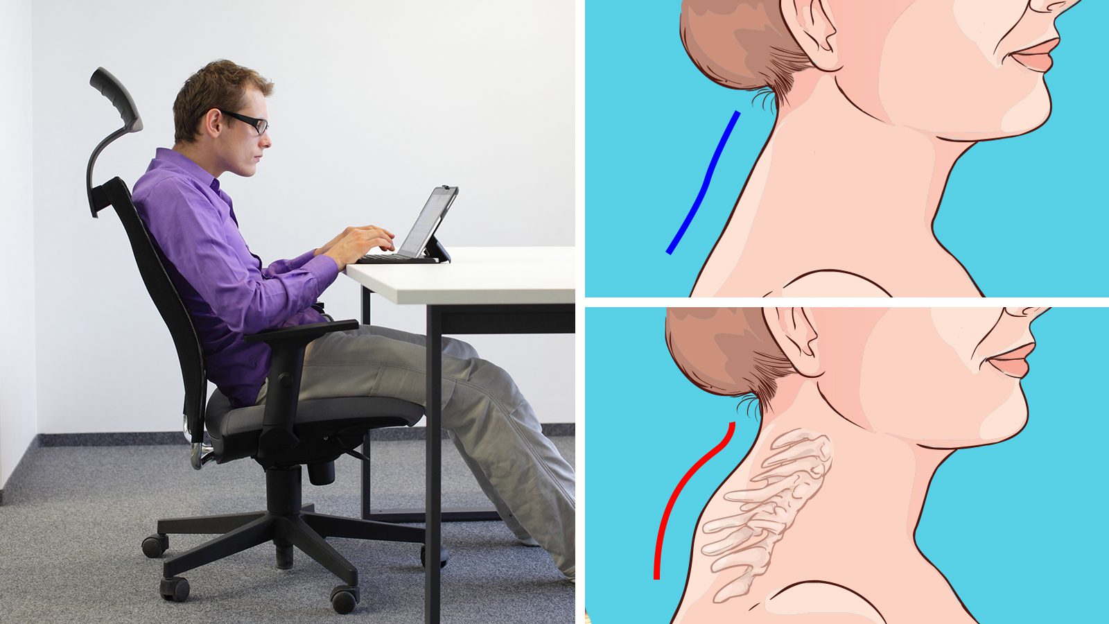 9 Reasons to Avoid Slouching
