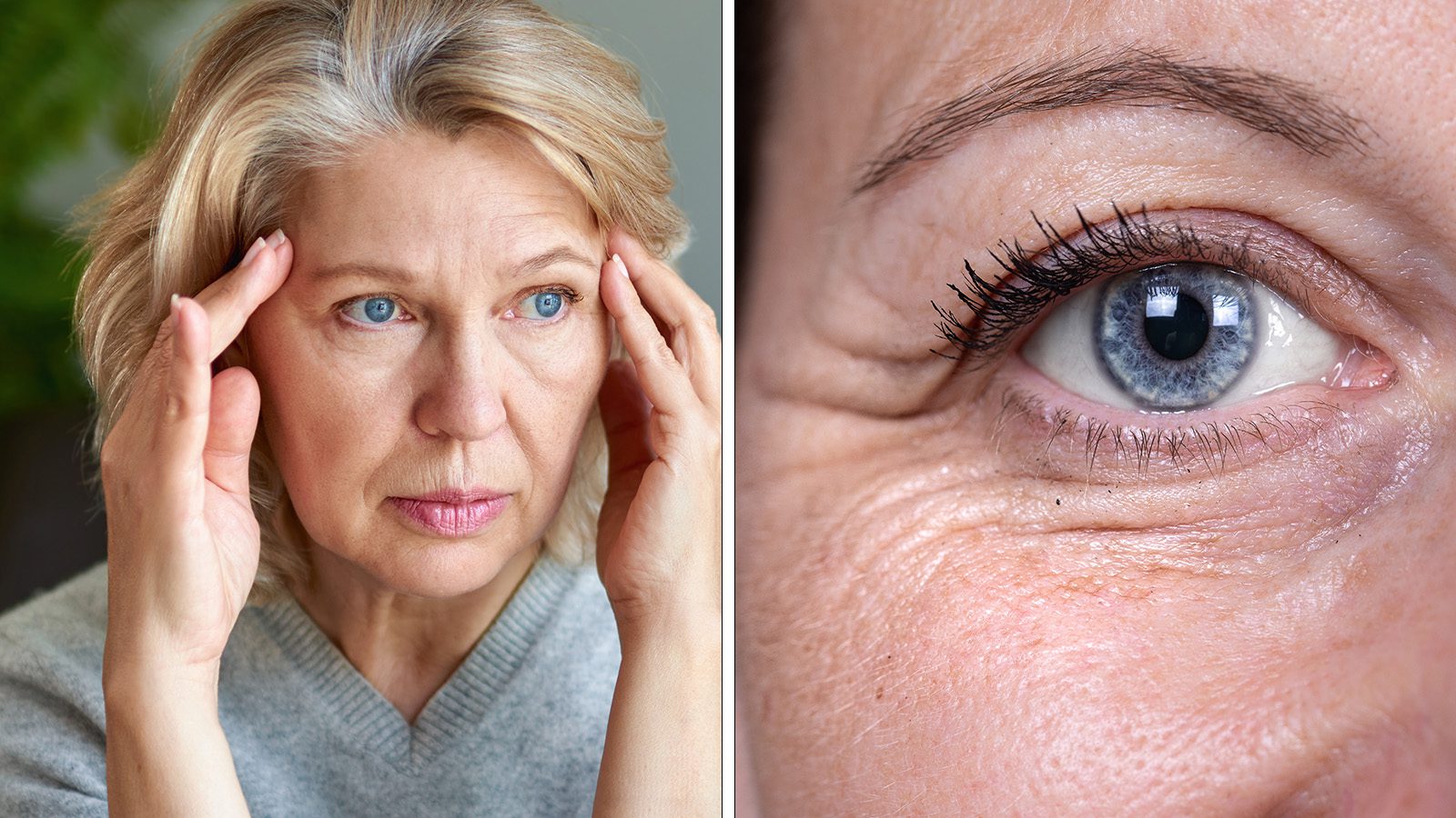 Science Explains the Link Between Stress and Wrinkles