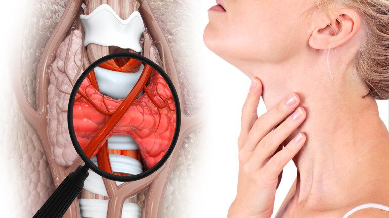 thyroid disorders