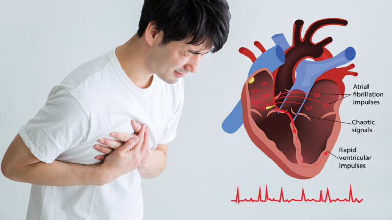 Prevent Heart Arrhythmias